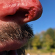 Illustration for article titled German Soccer Player Bites Off (And Maybe Eats?) Chunk Of Opponent's Nose